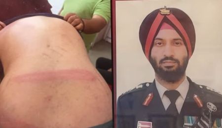 Image showing injuries allegedly suffered by Colonel Bath alongside a photograph of a Punjab Police officer.